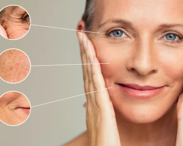 Signs of aging